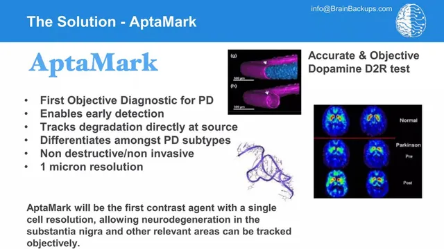 Product / solution slide 4 from Brain Backups