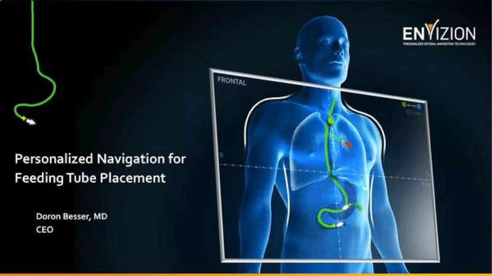 Envizion Medical pitch deck slide