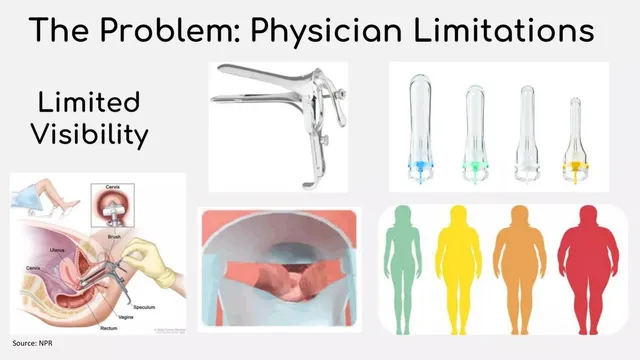 Problem slide 5 from Feminora