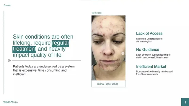Problem slide 3 from FORMEL Skin
