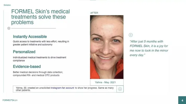 Product / solution slide 4 from FORMEL Skin